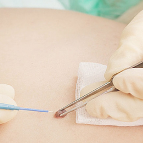 Dermatologia Cirúrgica